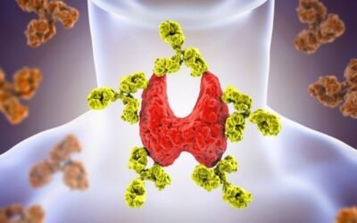 Hypothyroidism
